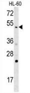 Nitric Oxide Synthase 1 Adaptor Protein antibody, AP52913PU-N, Origene, Western Blot image 