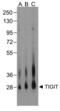 T Cell Immunoreceptor With Ig And ITIM Domains antibody, LS-C669097, Lifespan Biosciences, Western Blot image 