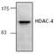 Histone Deacetylase 4 antibody, GTX21437, GeneTex, Western Blot image 