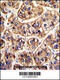Interferon Alpha And Beta Receptor Subunit 1 antibody, 63-512, ProSci, Immunohistochemistry paraffin image 