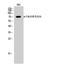 M-phase inducer phosphatase 2 antibody, A01899S323, Boster Biological Technology, Western Blot image 