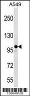 Zinc Finger CCCH-Type Containing 7A antibody, 59-481, ProSci, Western Blot image 