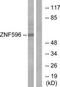 Zinc Finger Protein 596 antibody, TA316199, Origene, Western Blot image 