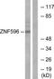 Zinc Finger Protein 596 antibody, TA316199, Origene, Western Blot image 