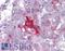Lemur Tyrosine Kinase 2 antibody, LS-B4518, Lifespan Biosciences, Immunohistochemistry paraffin image 