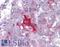 Serine/threonine-protein kinase LMTK2 antibody, LS-B4518, Lifespan Biosciences, Immunohistochemistry paraffin image 