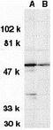 Serine/Threonine Kinase 17a antibody, GTX31646, GeneTex, Western Blot image 