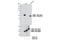 Calcium/Calmodulin Dependent Protein Kinase II Alpha antibody, 11945S, Cell Signaling Technology, Western Blot image 