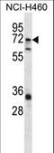 ST6 N-Acetylgalactosaminide Alpha-2,6-Sialyltransferase 1 antibody, LS-C161531, Lifespan Biosciences, Western Blot image 