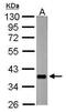 nrv2.1 antibody, PA5-32170, Invitrogen Antibodies, Western Blot image 