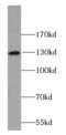 Bifunctional protein NCOAT antibody, FNab05164, FineTest, Western Blot image 