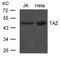 WW Domain Containing Transcription Regulator 1 antibody, GTX50808, GeneTex, Western Blot image 