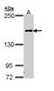 Complement C5 antibody, LS-C186223, Lifespan Biosciences, Western Blot image 