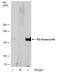 Phosphoinositide-3-Kinase Regulatory Subunit 4 antibody, PA5-78488, Invitrogen Antibodies, Immunoprecipitation image 