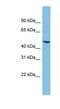 Chromosome 17 Open Reading Frame 75 antibody, NBP1-57746, Novus Biologicals, Western Blot image 