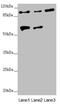 Tubulin Tyrosine Ligase Like 7 antibody, LS-C676658, Lifespan Biosciences, Western Blot image 