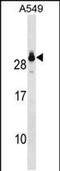 Glutathione S-Transferase Theta 2 (Gene/Pseudogene) antibody, PA5-49217, Invitrogen Antibodies, Western Blot image 