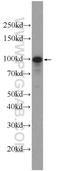 SPOC Domain Containing 1 antibody, 22243-1-AP, Proteintech Group, Western Blot image 