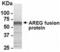 Amphiregulin antibody, XW-8171, ProSci, Western Blot image 