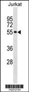 Splicing Factor 3a Subunit 2 antibody, 60-831, ProSci, Western Blot image 