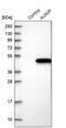 Aurora Kinase A And Ninein Interacting Protein antibody, PA5-55964, Invitrogen Antibodies, Western Blot image 