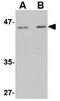 Ceramide Synthase 5 antibody, GTX31350, GeneTex, Western Blot image 