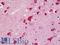 MYD88 Innate Immune Signal Transduction Adaptor antibody, LS-B11120, Lifespan Biosciences, Immunohistochemistry frozen image 