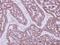 3-Hydroxyisobutyrate Dehydrogenase antibody, LS-C155742, Lifespan Biosciences, Immunohistochemistry paraffin image 