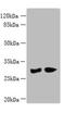 Phenazine Biosynthesis Like Protein Domain Containing antibody, A60178-100, Epigentek, Western Blot image 