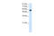 Nucleolar Complex Associated 4 Homolog antibody, ARP41005_P050, Aviva Systems Biology, Western Blot image 