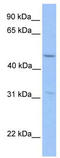 Zinc Finger Protein 296 antibody, TA330197, Origene, Western Blot image 