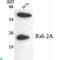 RAB2A, Member RAS Oncogene Family antibody, LS-C813109, Lifespan Biosciences, Western Blot image 