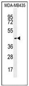 Olfactory Receptor Family 2 Subfamily L Member 13 antibody, AP53032PU-N, Origene, Western Blot image 