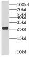 Secretogranin V antibody, FNab07700, FineTest, Western Blot image 