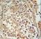 GTP Binding Protein 2 antibody, LS-C166735, Lifespan Biosciences, Immunohistochemistry paraffin image 