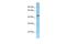 Family With Sequence Similarity 170 Member B antibody, A17088, Boster Biological Technology, Western Blot image 