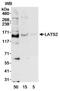 Large Tumor Suppressor Kinase 2 antibody, ab70565, Abcam, Western Blot image 