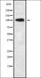 Carbonic Anhydrase 10 antibody, orb338130, Biorbyt, Western Blot image 