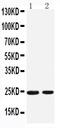 RAB2A, Member RAS Oncogene Family antibody, PA2306, Boster Biological Technology, Western Blot image 