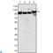 MutS Homolog 2 antibody, LS-C812704, Lifespan Biosciences, Western Blot image 