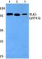 Tousled Like Kinase 1 antibody, PA5-37340, Invitrogen Antibodies, Western Blot image 