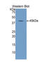 Endothelial Cell Adhesion Molecule antibody, LS-C293749, Lifespan Biosciences, Western Blot image 