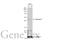 Galectin 3 antibody, GTX635156, GeneTex, Western Blot image 