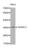 Homeobox A11 antibody, abx002166, Abbexa, Western Blot image 