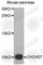 Coiled-Coil-Helix-Coiled-Coil-Helix Domain Containing 7 antibody, A3491, ABclonal Technology, Western Blot image 