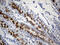 Vesicle Associated Membrane Protein 5 antibody, M11353, Boster Biological Technology, Immunohistochemistry paraffin image 