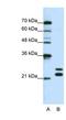 Cold Shock Domain Containing C2 antibody, NBP1-70673, Novus Biologicals, Western Blot image 