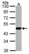 Uridine Monophosphate Synthetase antibody, GTX114872, GeneTex, Western Blot image 