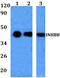 Inhibin Subunit Beta B antibody, GTX66793, GeneTex, Western Blot image 