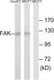 Protein Tyrosine Kinase 2 antibody, LS-C118286, Lifespan Biosciences, Western Blot image 
